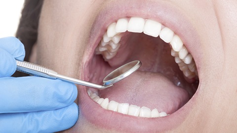 Dents